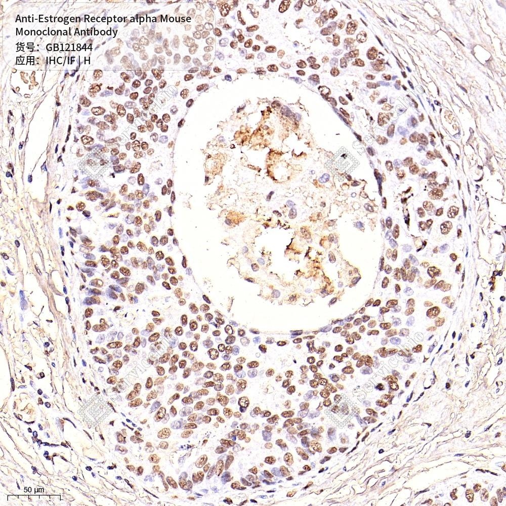 Антитела первичные, моноклональные мыши к Estrogen Receptor alpha человека, 50 мкл