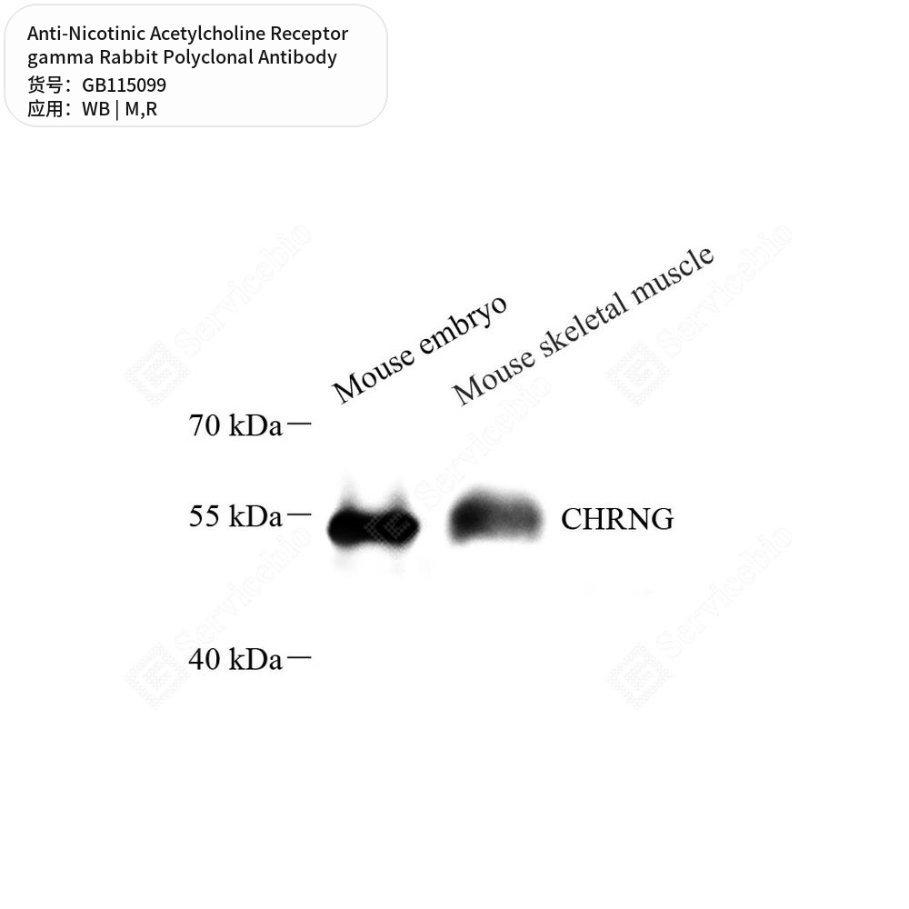Антитела первичные, поликл. кролика к Nicotinic Acetylcholine Receptor gamma крысы, мыши, 50 мкл