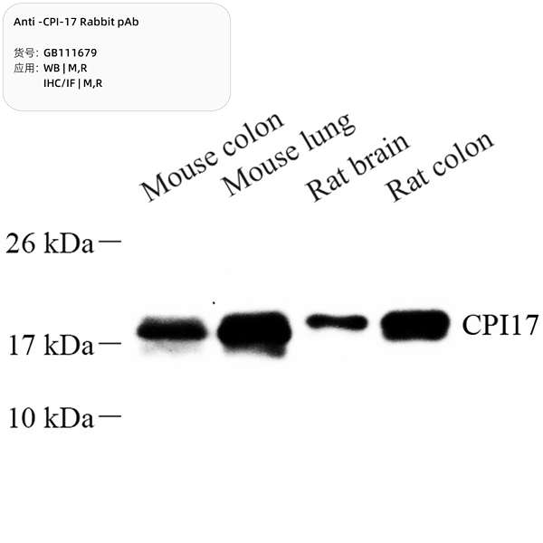 Антитела первичные, поликлональные, CPI-17, 100 мкл