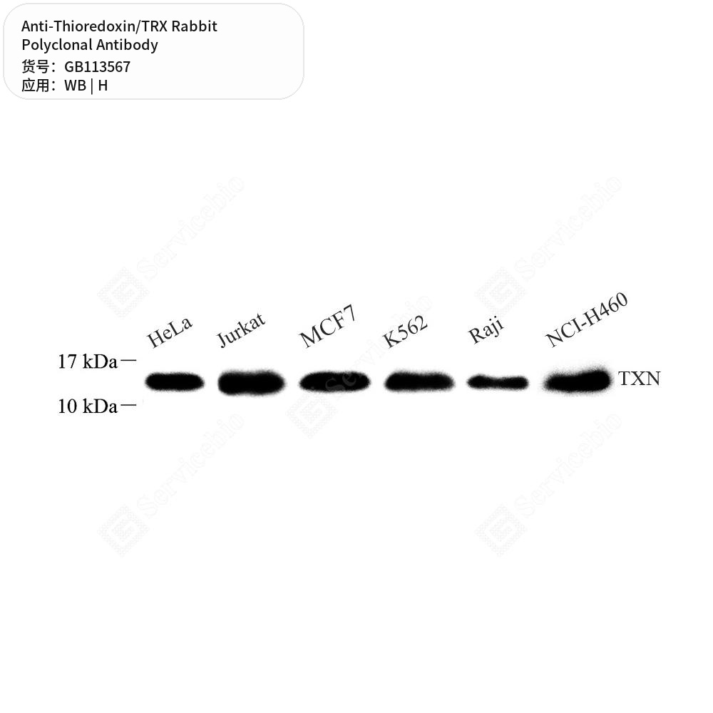 Антитела первичные, поликлональные кролика к Thioredoxin/TRX человека, 100 мкл