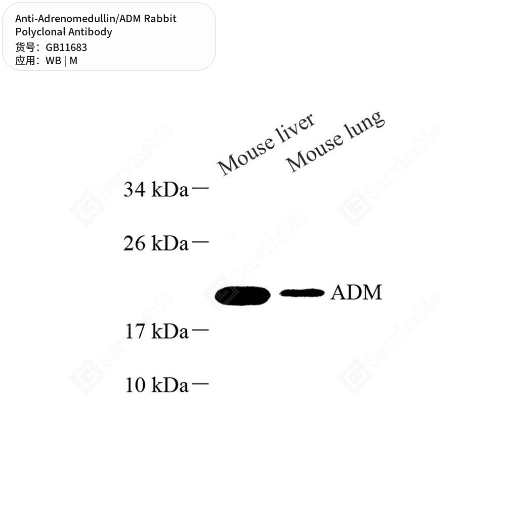 Антитела первичные, поликлональные кролика к Adrenomedullin/ADM мыши, 100 мкл