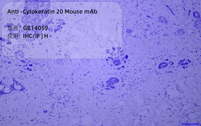 Антитела первичные, моноклональные мыши к Cytokeratin 20 человека, 50 мкл