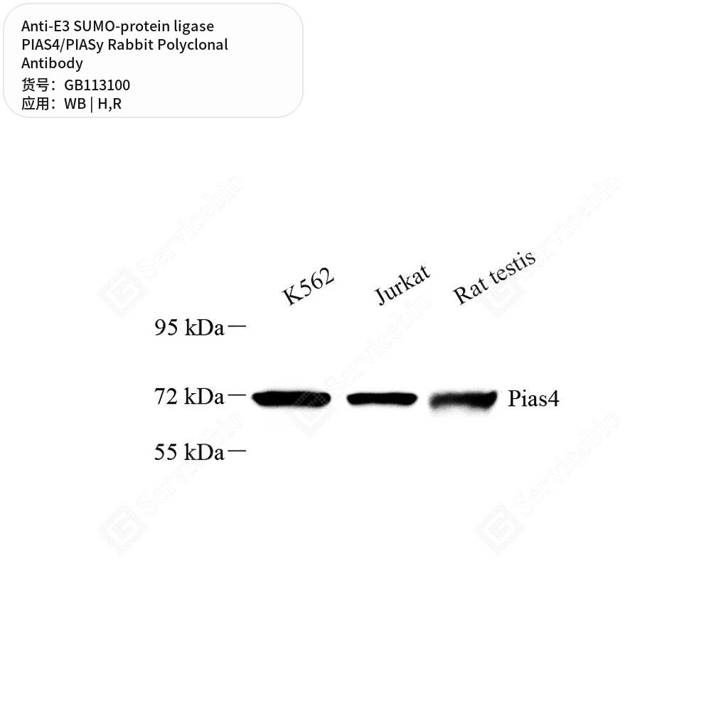 Антитела первичные, поликл. кролика к E3 SUMO-protein ligase PIAS4/PIASy крысы, человека, 50 мкл