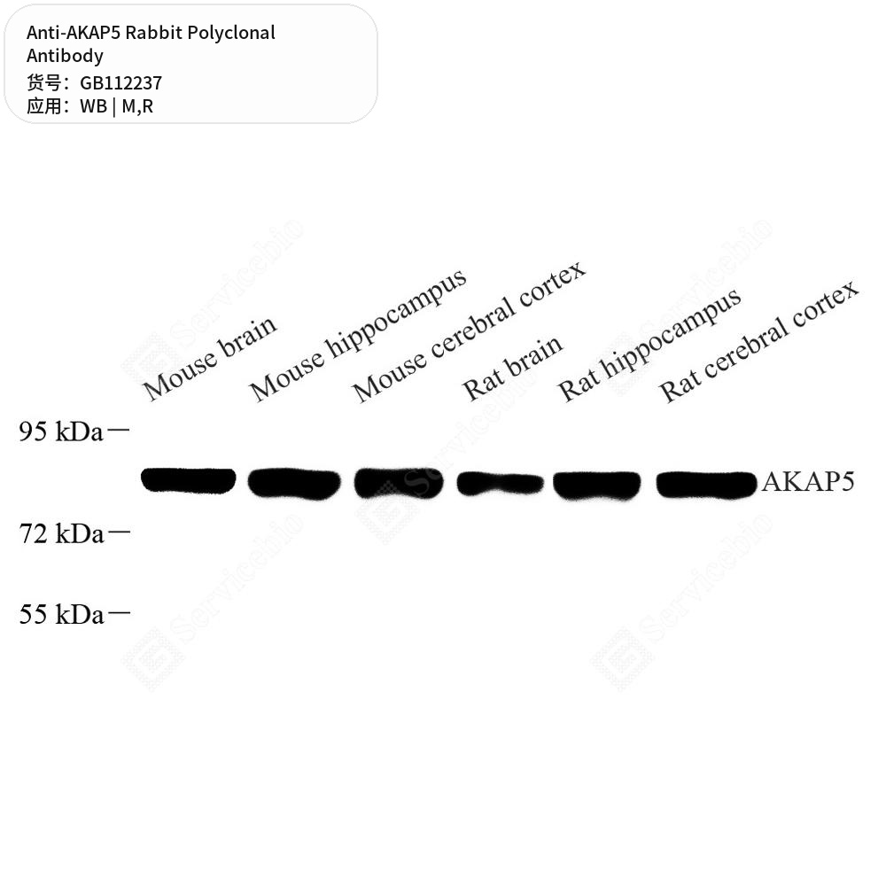 Антитела первичные, поликлональные кролика к AKAP5 крысы, мыши, 100 мкл