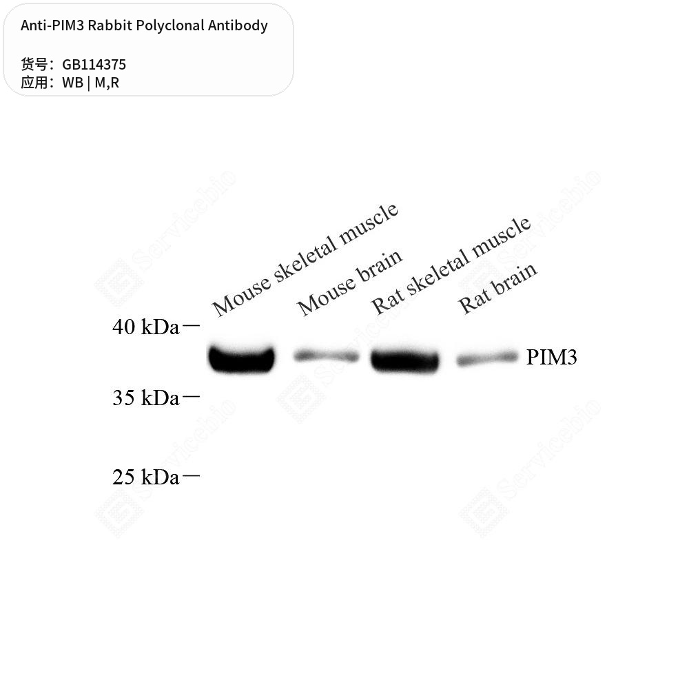Антитела первичные, поликлональные кролика к PIM3 крысы, мыши, 50 мкл