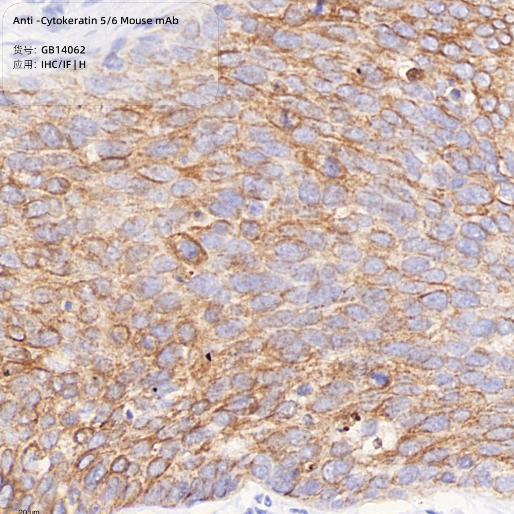Антитела первичные, моноклональные мыши к Cytokeratin 5/6 человека, 50 мкл
