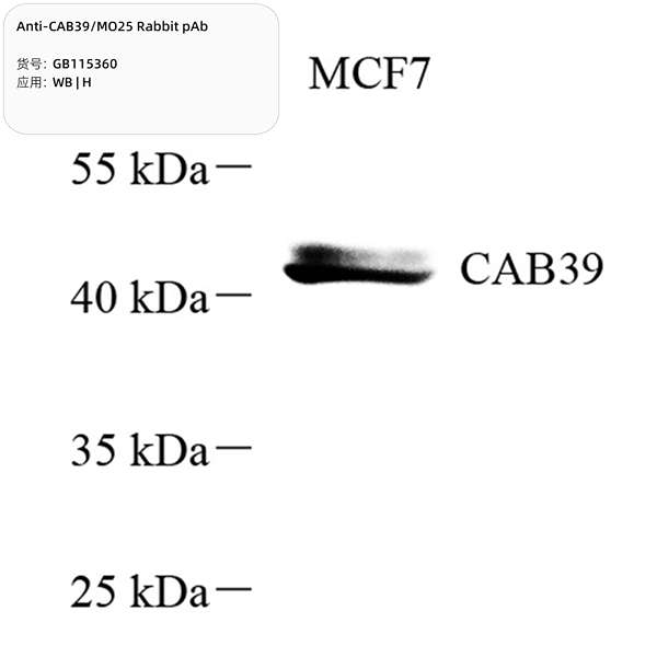 Антитела первичные, поликлональные, CAB39/MO25, 100 мкл