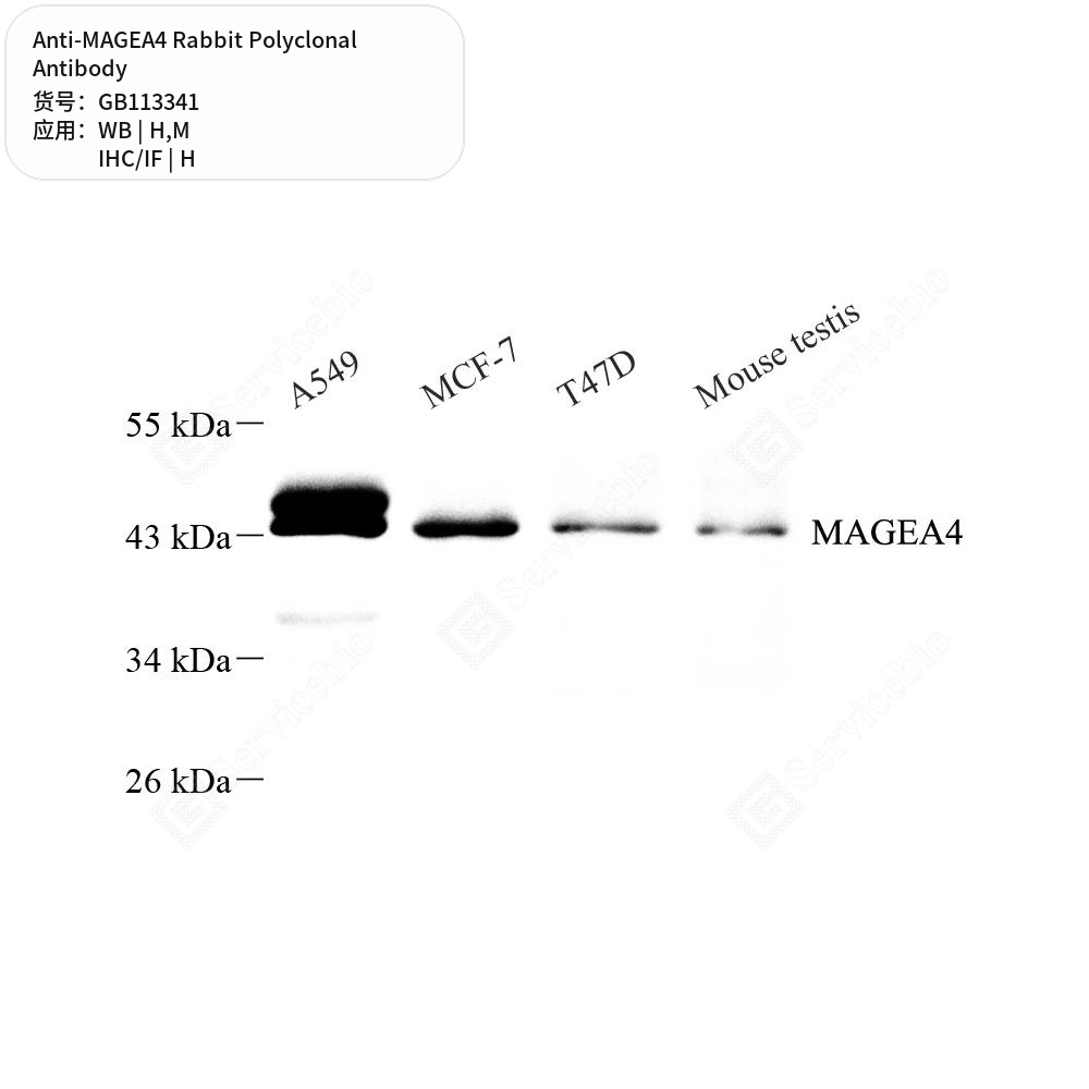 Антитела первичные, поликлональные кролика к MAGEA4 мыши, человека, 100 мкл