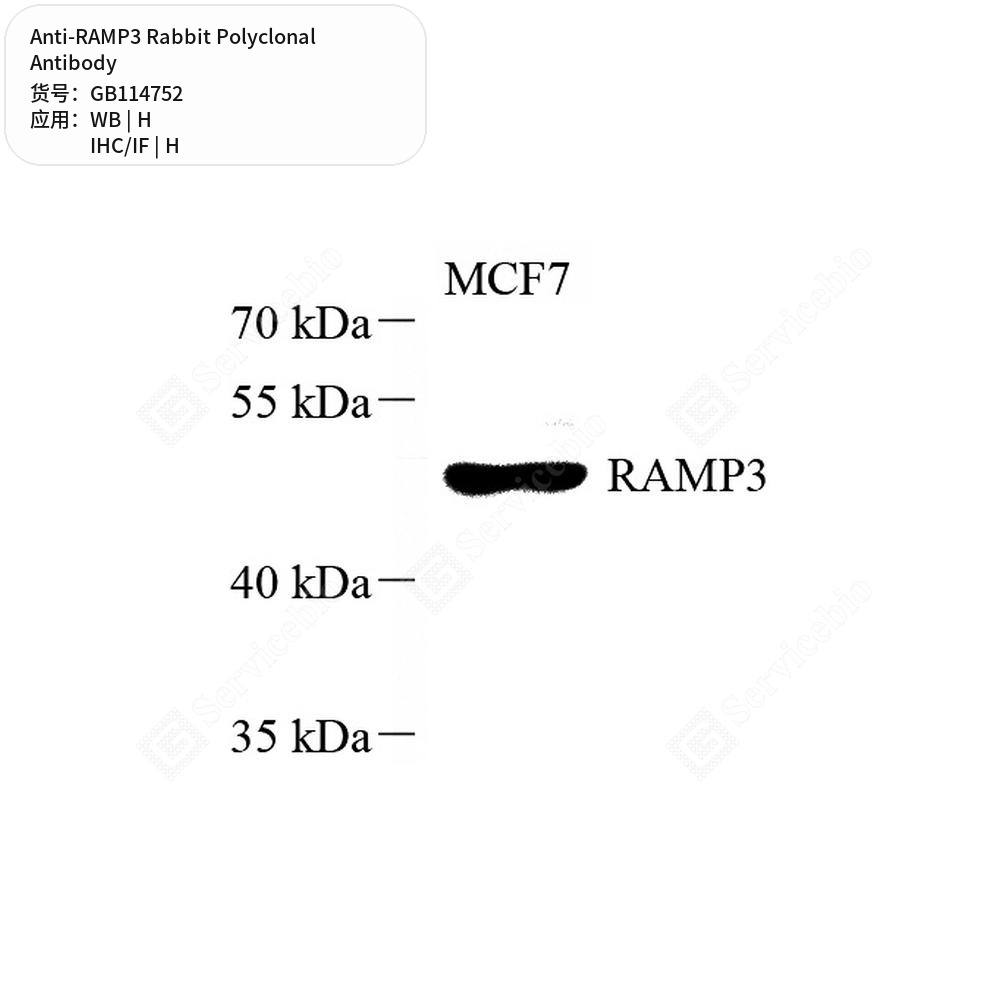 Антитела первичные, поликлональные кролика к RAMP3 человека, 100 мкл