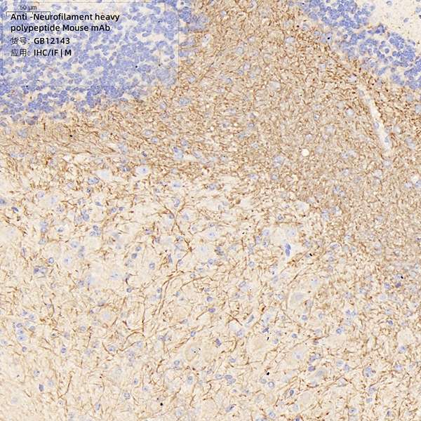Антитела первичные, моноклональные, Neurofilament heavy polypeptide, 100 мкл
