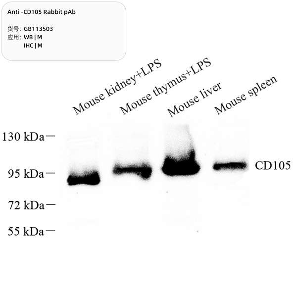 Антитела первичные, поликлональные, CD105, 100 мкл