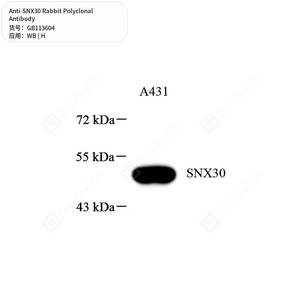 Антитела первичные, поликлональные кролика к SNX30 человека, 100 мкл