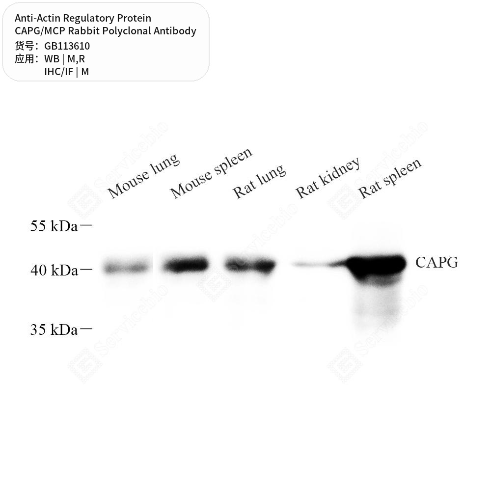 Антитела первичные, поликлональные кролика к Actin Regulatory Protein CAPG/MCP крысы, мыши, 50 мкл