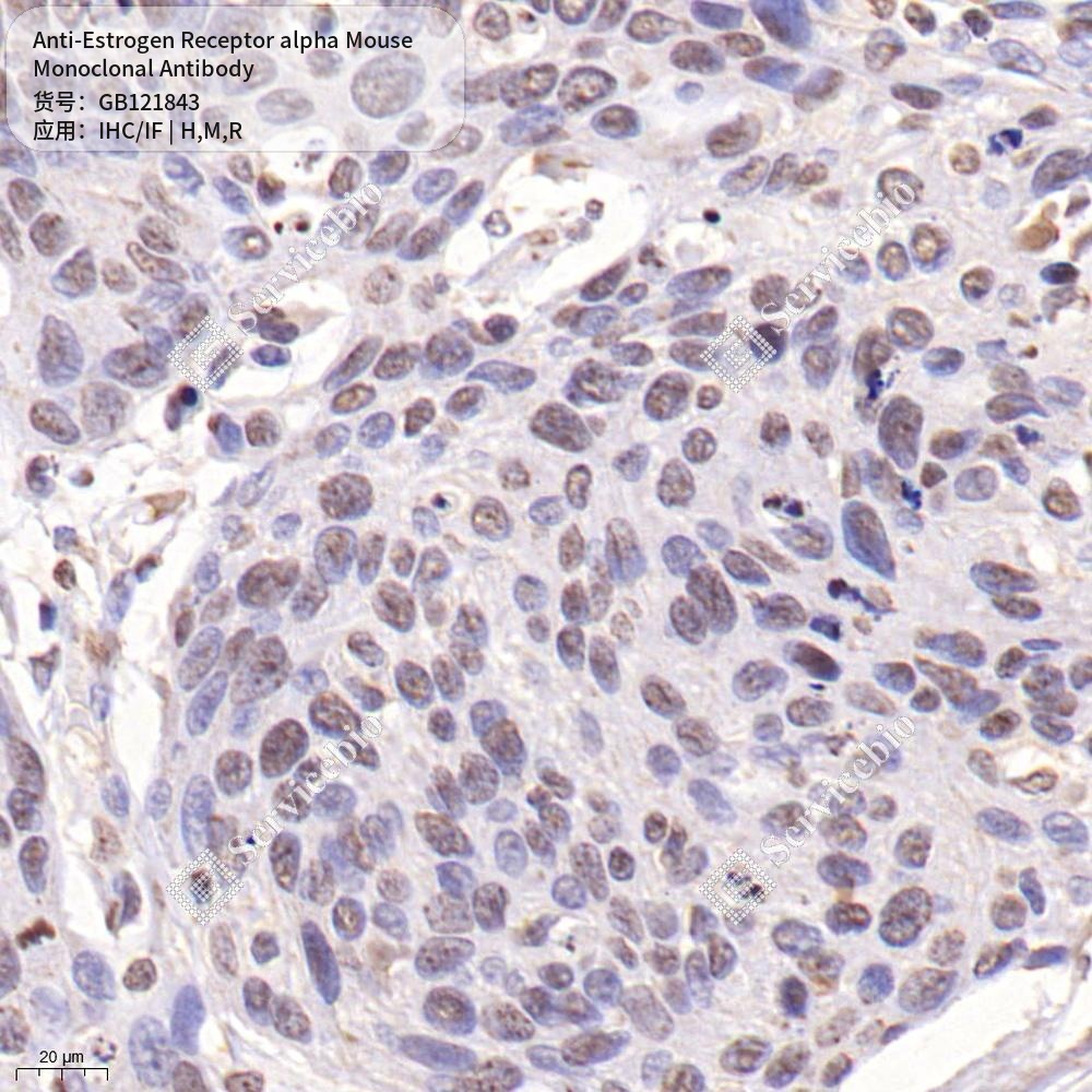 Антитела первичные, моноклональные мыши к Estrogen Receptor alpha крысы, мыши, человека, 50 мкл
