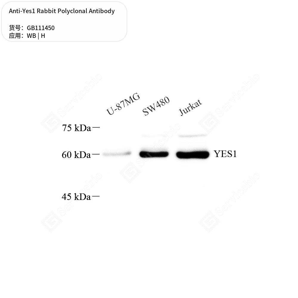 Антитела первичные, поликлональные кролика к Yes1 человека, 50 мкл