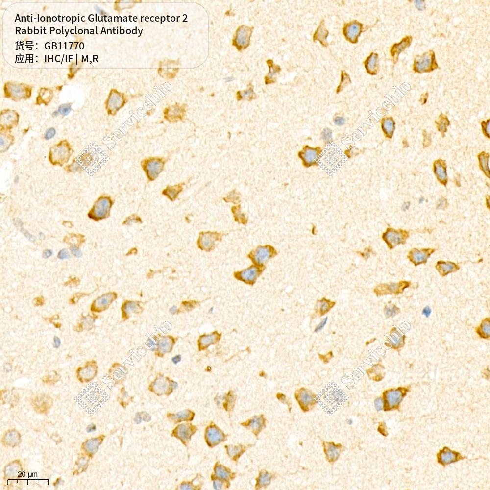 Антитела первичные, поликлональные кролика к Ionotropic Glutamate receptor 2 крысы, мыши, 50 мкл