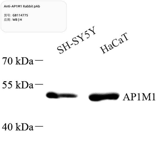 Антитела первичные, поликлональные, AP1M1, 100 мкл
