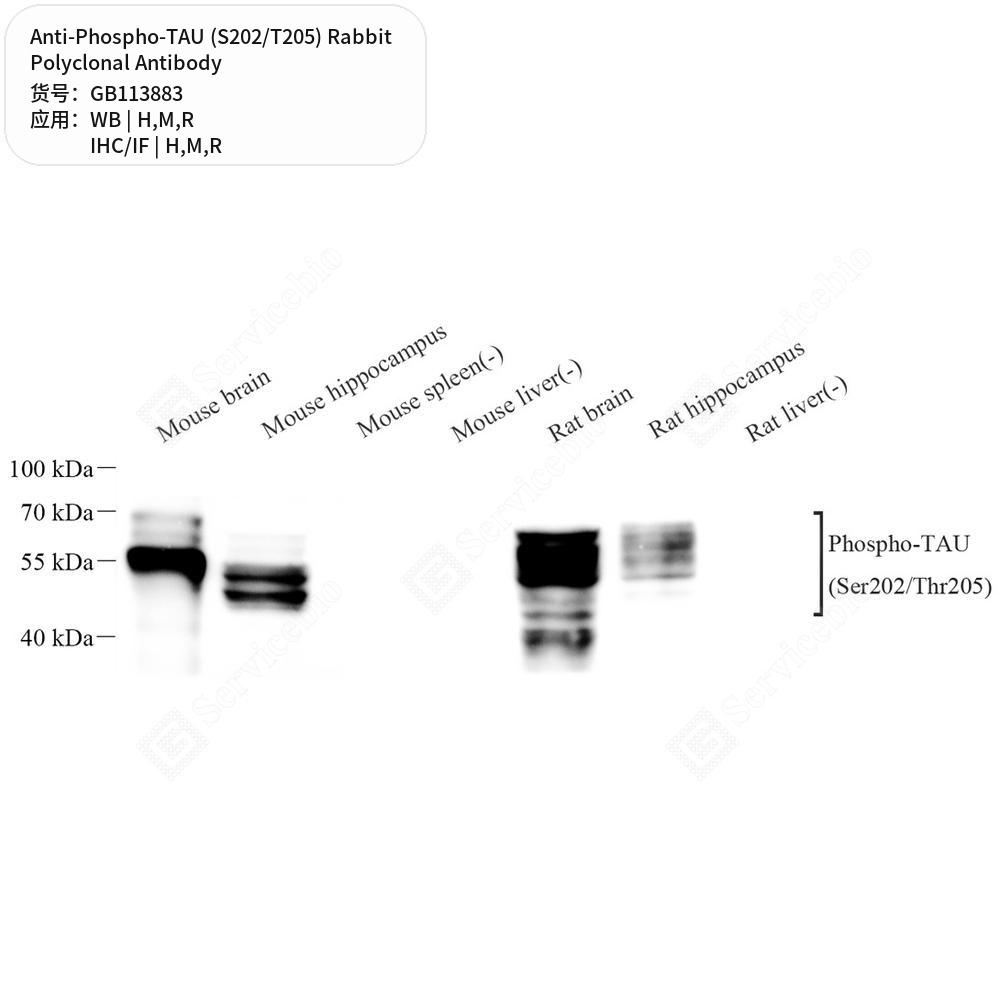 Антитела первичные, поликлональные кролика к Phospho-TAU (S202/T205) крысы, мыши, человека, 100 мкл
