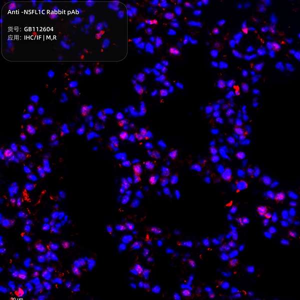 Антитела первичные, поликлональные, NSFL1C, 100 мкл