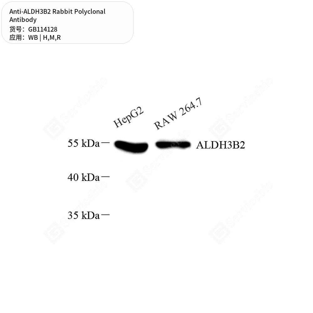 Антитела первичные, поликлональные кролика к ALDH3B2 крысы, мыши, человека, 50 мкл