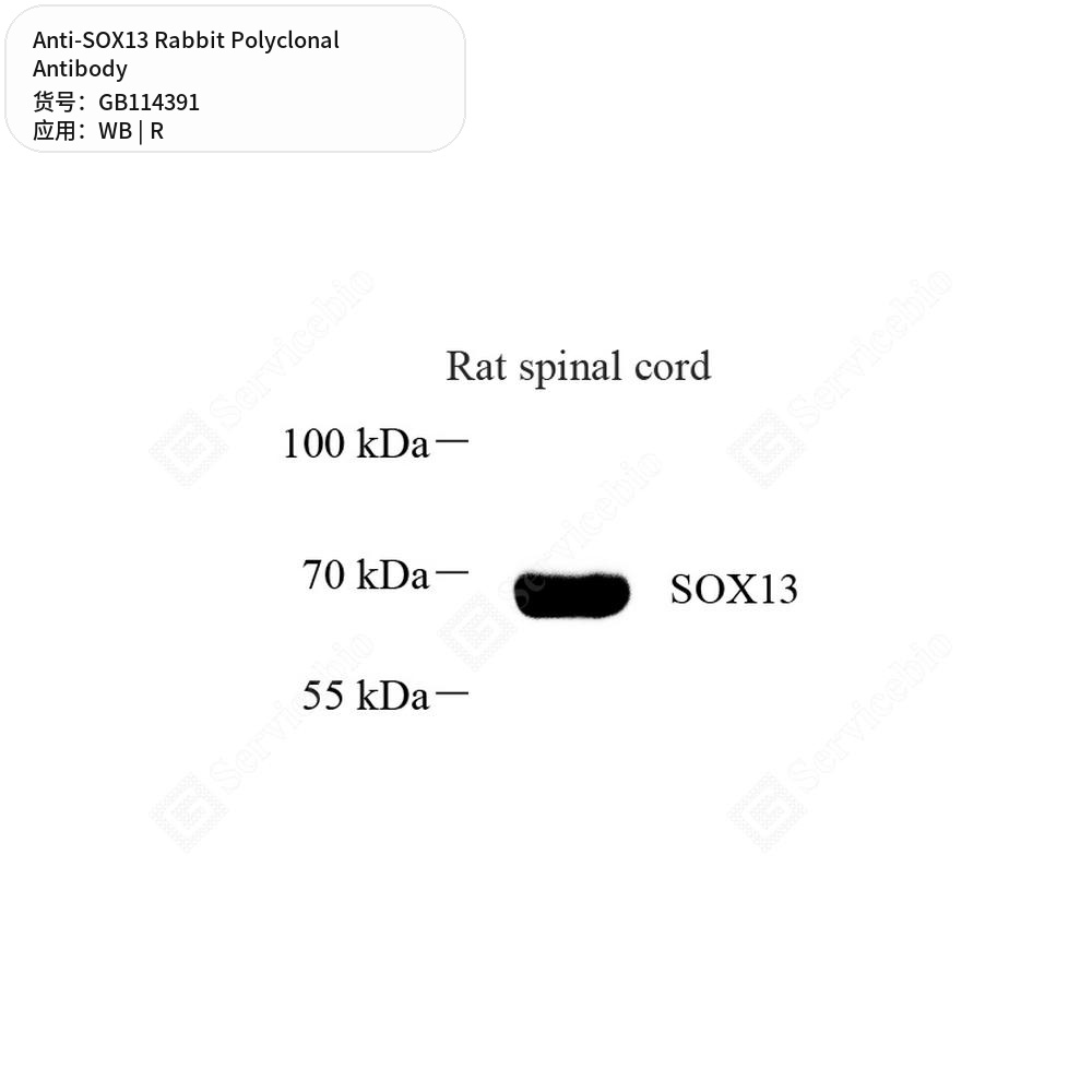 Антитела первичные, поликлональные кролика к SOX13 крысы, 100 мкл