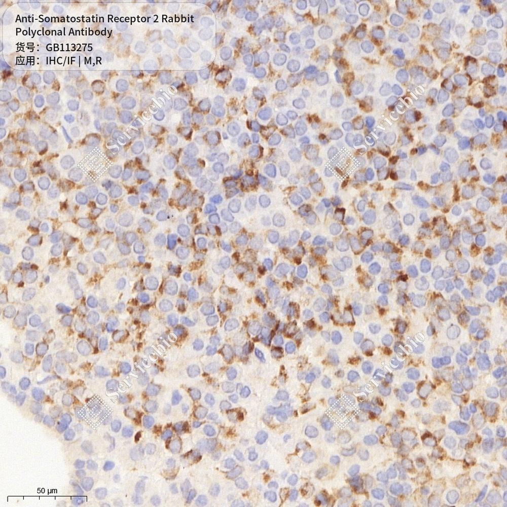 Антитела первичные, поликлональные кролика к Somatostatin Receptor 2 крысы, мыши, 50 мкл
