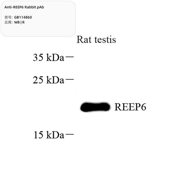 Антитела первичные, поликлональные, REEP6, 100 мкл