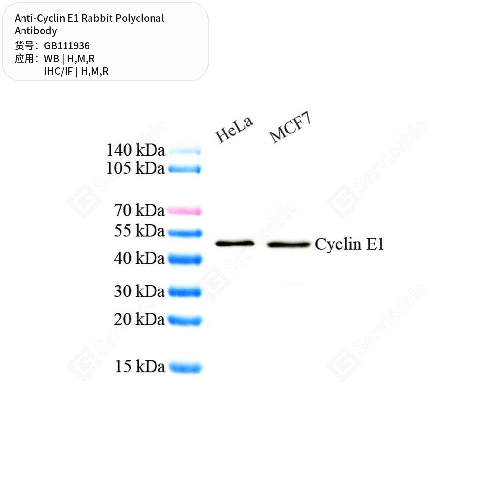 Антитела первичные, поликлональные кролика к Cyclin E1 крысы, мыши, человека, 100 мкл