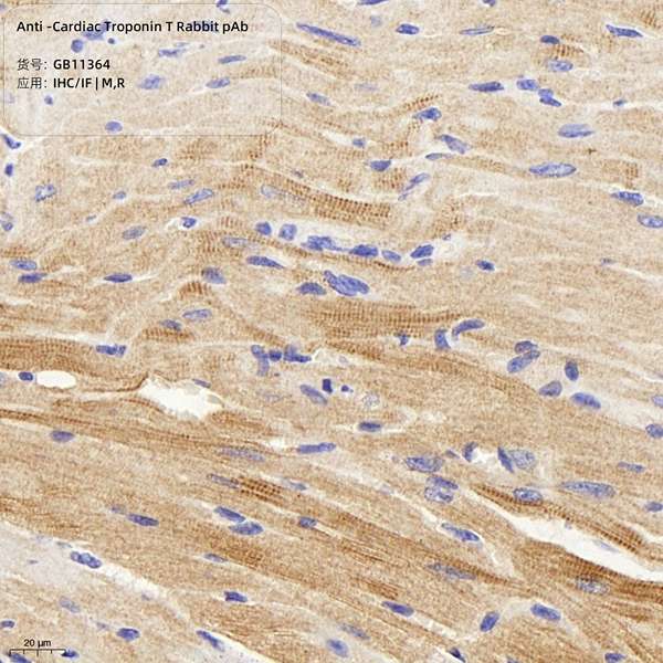 Антитела первичные, поликлональные, Cardiac Troponin T, 100 мкл