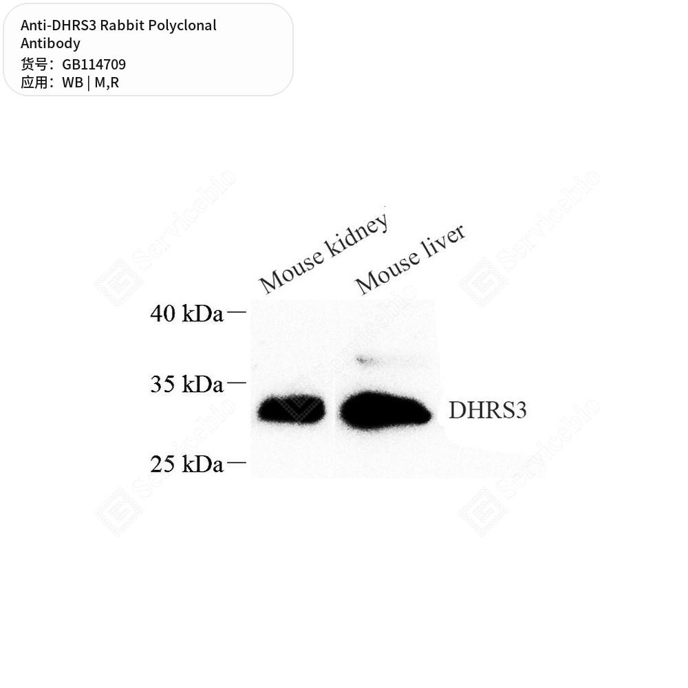 Антитела первичные, поликлональные кролика к DHRS3 крысы, мыши, 50 мкл
