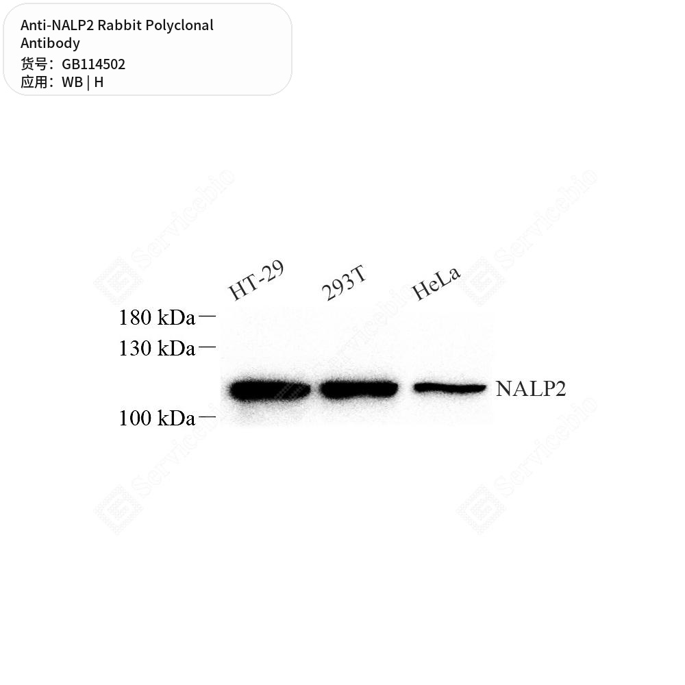 Антитела первичные, поликлональные кролика к NALP2 человека, 100 мкл