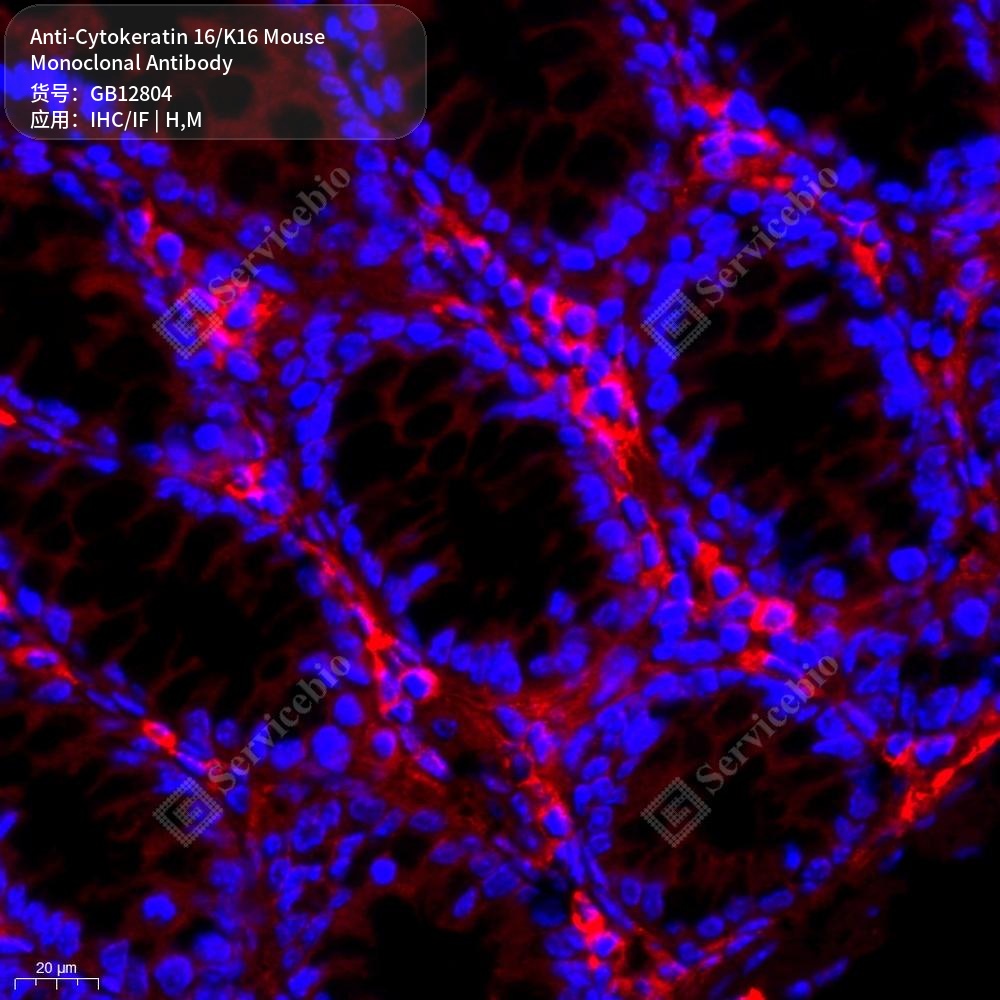 Антитела первичные, моноклональные мыши к Cytokeratin 16/K16 мыши, человека, 50 мкл