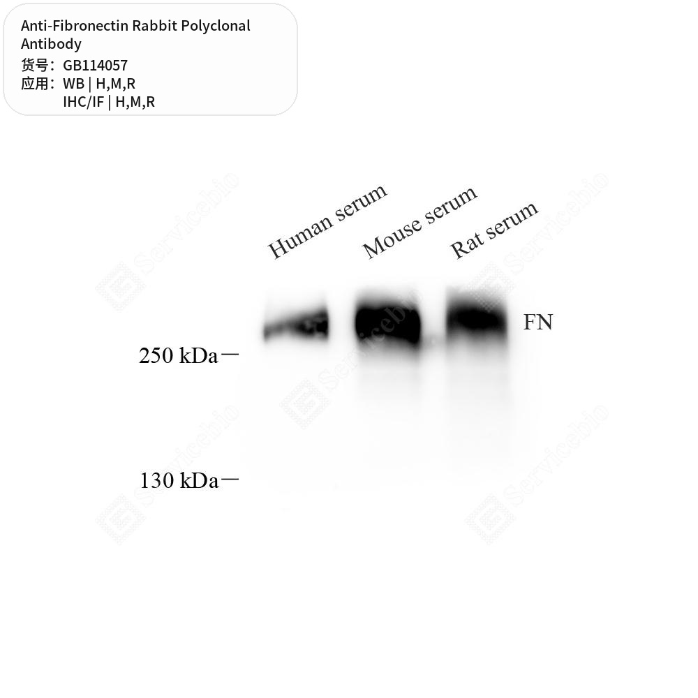 Антитела первичные, поликлональные кролика к Fibronectin крысы, мыши, человека, 50 мкл