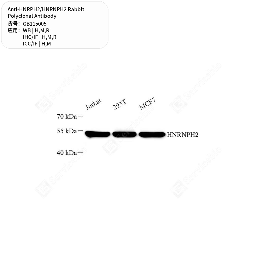 Антитела первичные, поликлональные кролика к HNRPH2/HNRNPH2 крысы, мыши, человека, 50 мкл