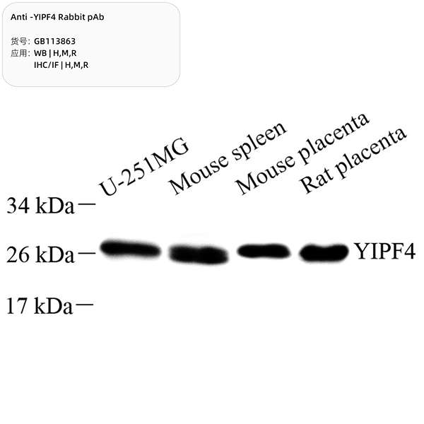 Антитела первичные, поликлональные, YIPF4, 100 мкл
