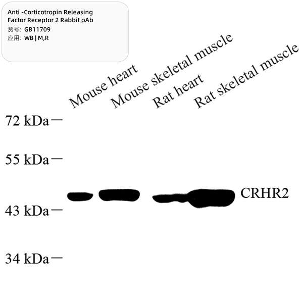 Антитела первичные, поликлональные, Corticotropin Releasing Factor Receptor 2, 100 мкл