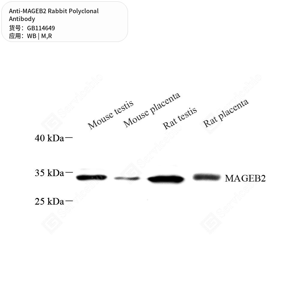Антитела первичные, поликлональные кролика к MAGEB2 крысы, мыши, 50 мкл