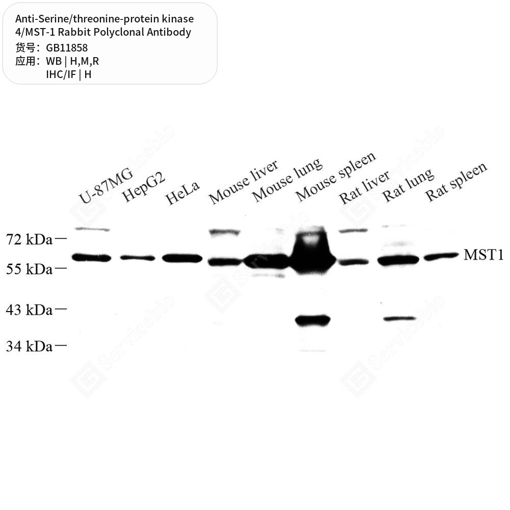 Антитела первичные, пол. крол. к Serine/threonine-protein kinase 4/MST-1 крысы, мыши, чел., 50 мкл