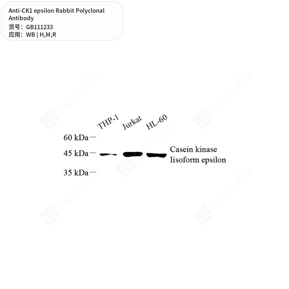 Антитела первичные, поликлональные кролика к CK1 epsilon крысы, мыши, человека, 100 мкл
