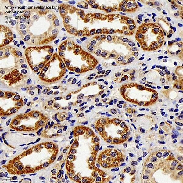 Антитела первичные, поликлональные, Phosphomevalonate kinase, 100 мкл
