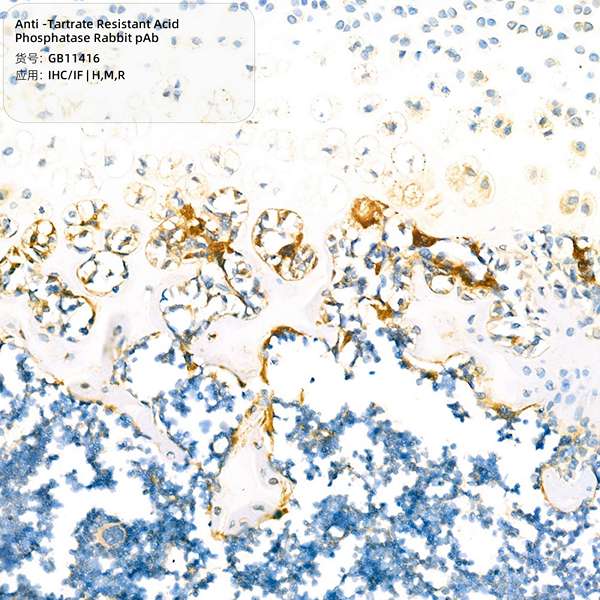 Антитела первичные, поликлональные, Tartrate Resistant Acid Phosphatase, 100 мкл