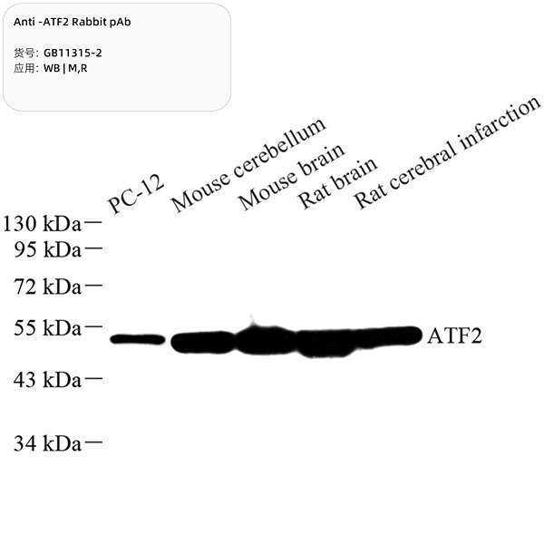 Антитела первичные, поликлональные, ATF2, 100 мкл