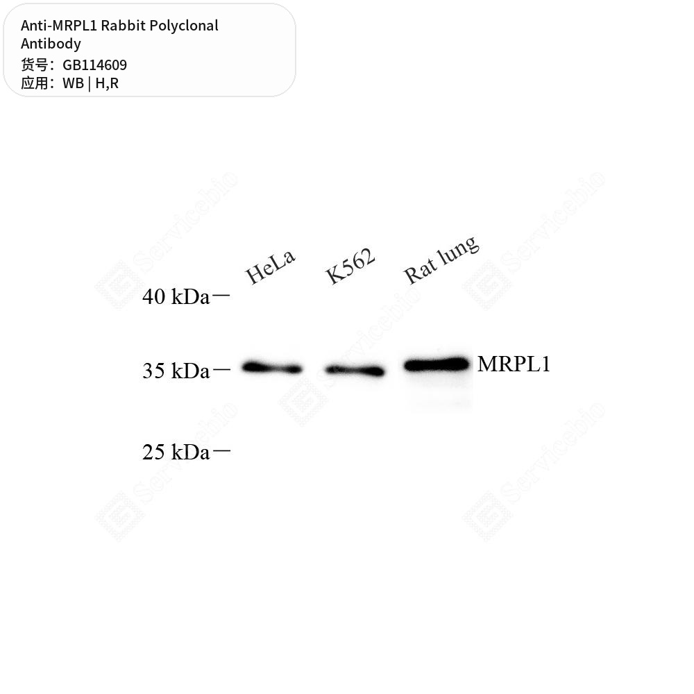 Антитела первичные, поликлональные кролика к MRPL1 крысы, человека, 100 мкл