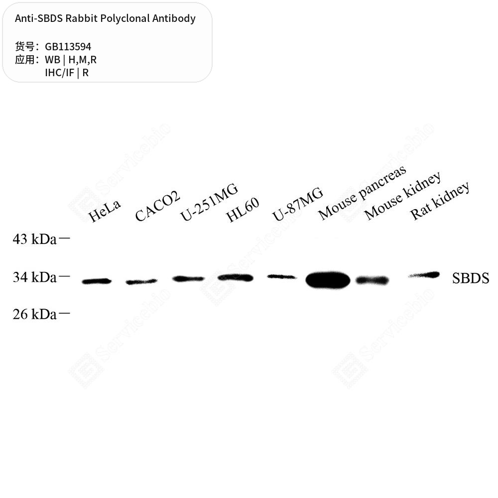 Антитела первичные, поликлональные кролика к SBDS крысы, мыши, человека, 50 мкл