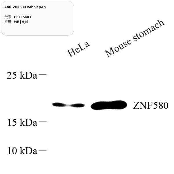 Антитела первичные, поликлональные, ZNF580, 100 мкл