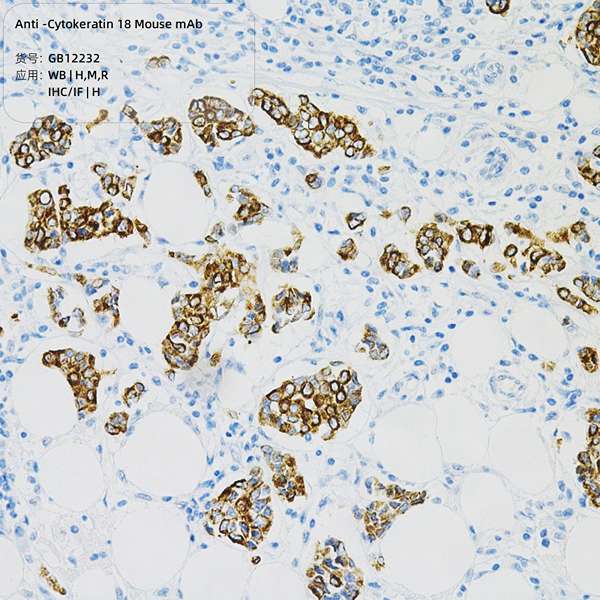 Антитела первичные, моноклональные, Cytokeratin 18, 100 мкл