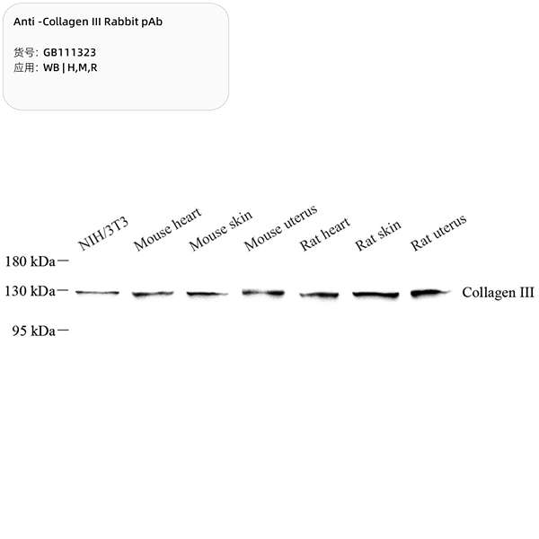 Антитела первичные, поликлональные, Collagen III, 100 мкл