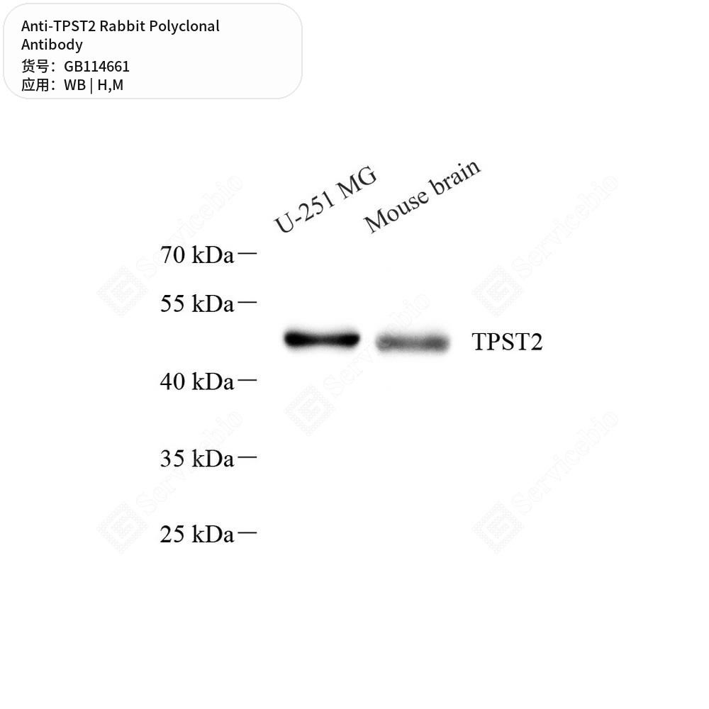 Антитела первичные, поликлональные кролика к TPST2 мыши, человека, 50 мкл