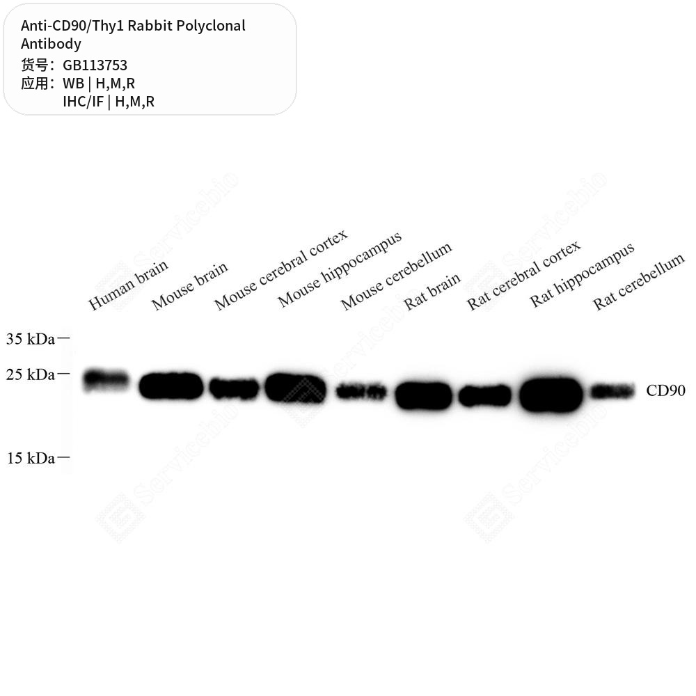 Антитела первичные, поликлональные кролика к CD90/Thy1 крысы, мыши, человека, 50 мкл