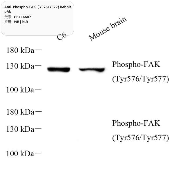 Антитела первичные, поликлональные, Phospho-FAK (Y576/Y577), 100 мкл